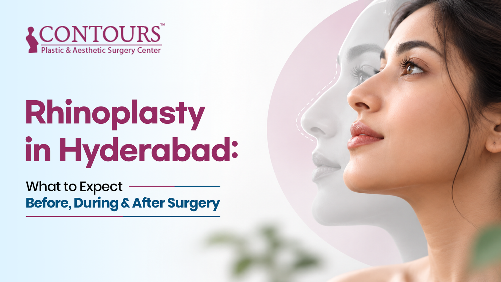 Rhinoplasty in Hyderabad: What to Expect Before, During and After Surgery